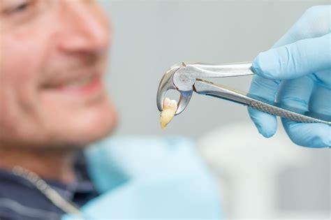 Tooth extraction - Dental Health Associates