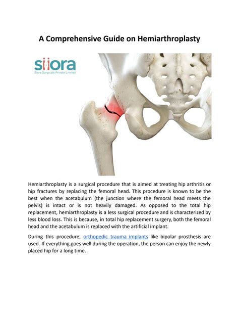 A Comprehensive Guide on Hemiarthroplasty by Siora 966 - Issuu