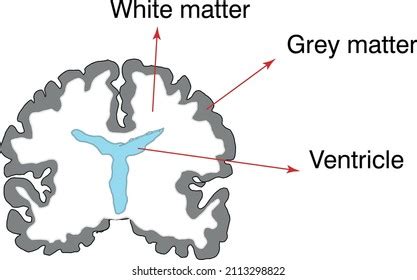 Brain Cross Section White Grey Matter Stock Vector (Royalty Free ...