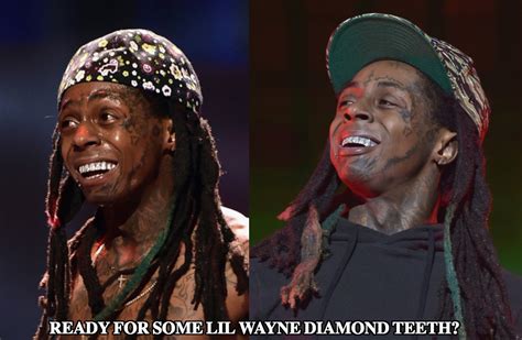 Lil Wayne Teeth - Diamonds Make His Words Precious! - Latest Plastic ...