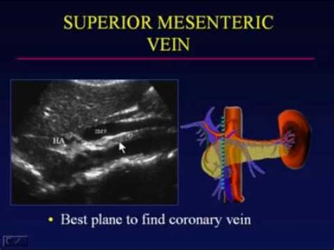 Superior Mesenteric Vein Ultrasound