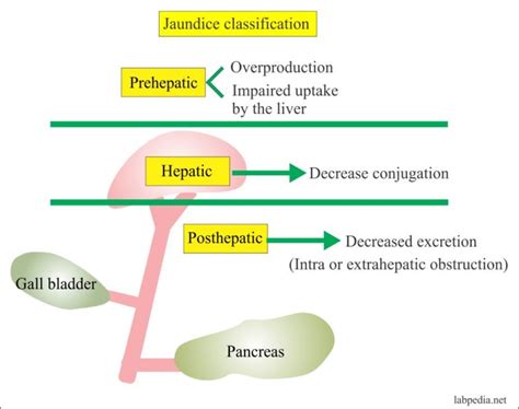 Bilirubin -Part 1- Total, Direct and Indirect Bilirubin, Classification ...