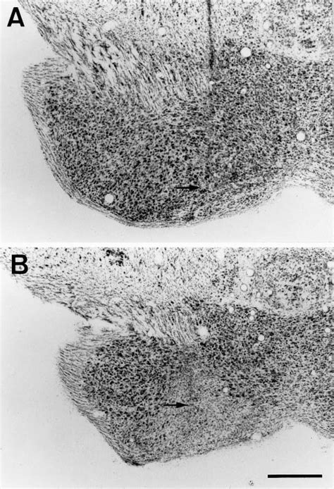 Effects of NMDA and non-NMDA receptor antagonists on NMDA neurotoxicity ...