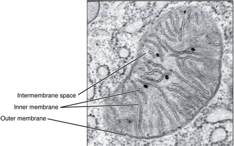 Mitochondria Electron Micrograph Labelled