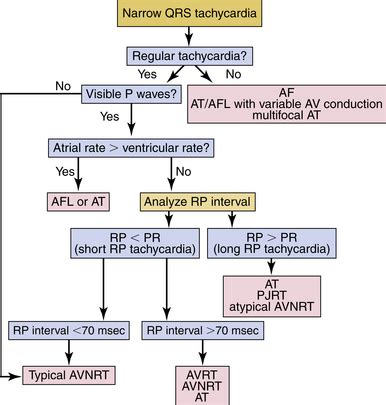 Approach to Paroxysmal Supraventricular Tachycardias | Musculoskeletal Key