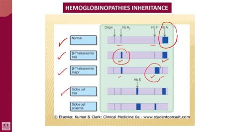 Hemoglobin Sc Disease Electrophoresis - Pregnancy Depression