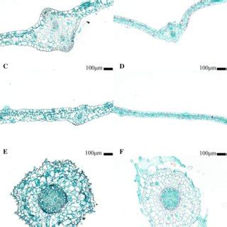 Comparison of morphological characteristics between tetraploid and... | Download Scientific Diagram