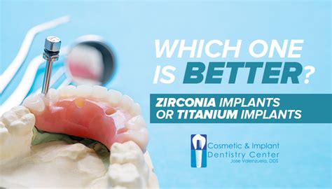 Zirconia Implants or Titanium implants? Which one is better? 😏😁