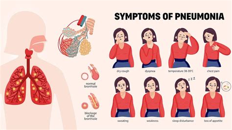 What Causes Pneumonia and How Serious Is It? | OnlyMyHealth