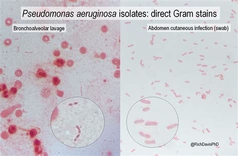 Pseudomonas Aeruginosa Gram Stain