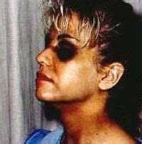 Karla Homolka Crime Scene Photos