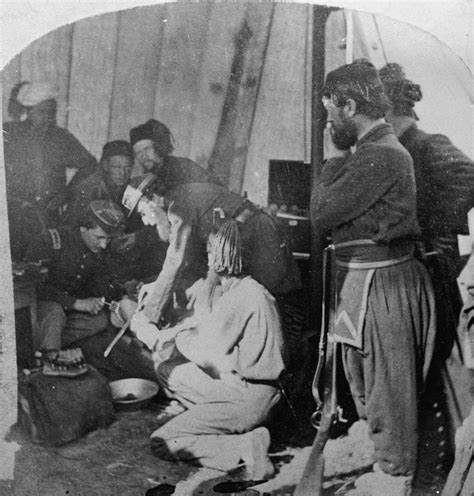 Bloodcurdling Tales And Photos of Amputations From The American Civil War - Flashbak