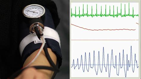 Automated 'oscillometric' Blood Pressure Measuring Devices:, 41% OFF