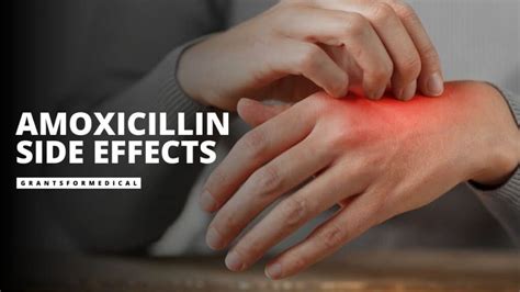 Amoxicillin Side Effects You Should Know About