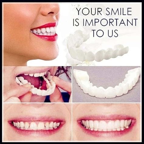 Fake Teeth Cosmetic Denture Veneers for Upper and Lower Jaw- Natural ...