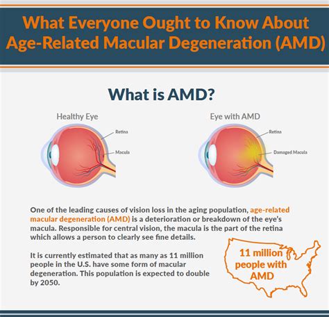 What Is AMD? | Macular degeneration, Eye health, Healthy eyes