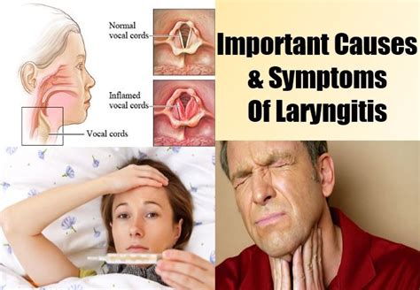 Important Causes And Symptoms Of Laryngitis | Symptoms, Laryngitis symptoms, Get healthy