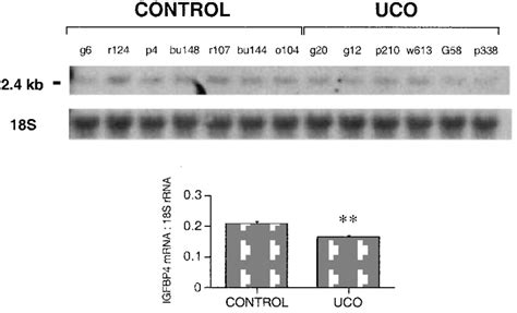 Northern blot hybridization of total RNA (20 g per lane) from preterm ...