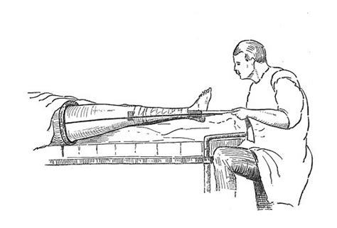 Thomas's splint, fractures free public domain image | Look and Learn