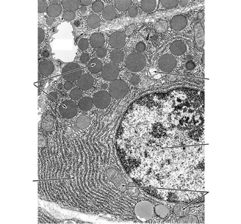 Mitochondria Electron Micrograph Labelled