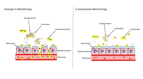 Exploring a key relationship between virulence factors that drive high ...