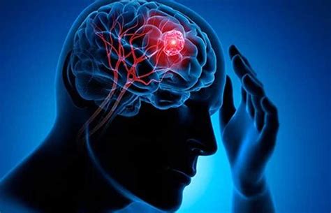 How are brain tumours caused and how can they be treated?