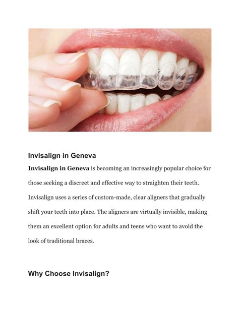 PPT - Top Invisalign Providers in Geneva PowerPoint Presentation, free download - ID:13265520