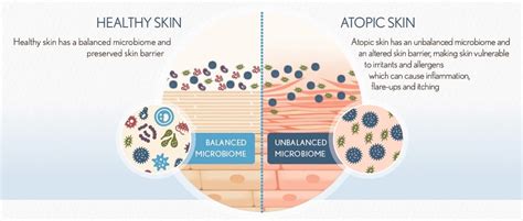 Skin Microbiome | AveenoMD®