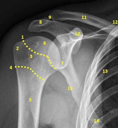 Shoulder Anatomy X Ray Labeled