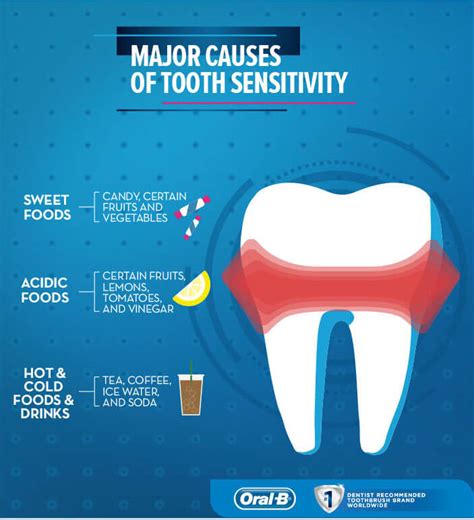 Top 10 Causes of Sensitive Teeth - GPS Dental