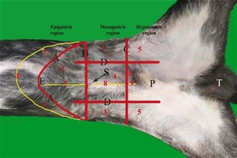 Midline Abdominal Incision