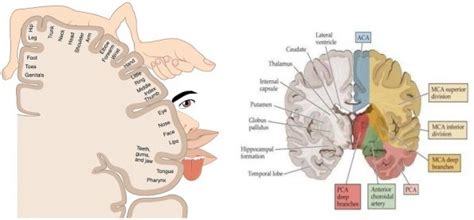 Identifying stroke mimics in the ED - EMOttawa Blog