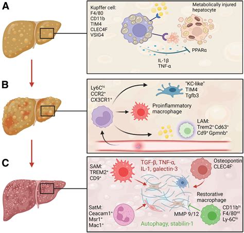 Macrophages foster progression from nonalcoholic fatty liver to NASH ...