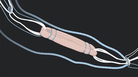 Arthrex - GraftLink® ACL Reconstruction Using TightRope® II Implant for ...