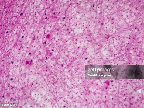 39 Collagen Fibers Histology Stock Photos, High-Res Pictures, and Images - Getty Images