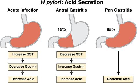 Lustaság folytatni egzotikus gastric acid test átlyukasztás átlós Ketyegés