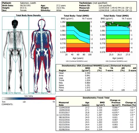 How to Read DEXA Scan Results