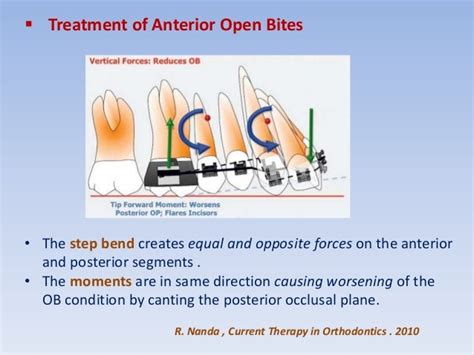 Anterior open bite treatment permanent dentition -1- .slide