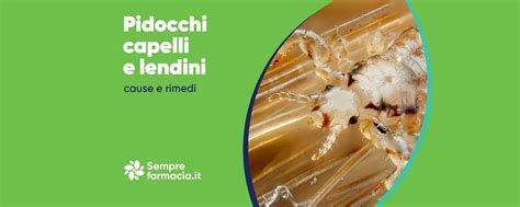 Pidocchi capelli e lendini: rimedi e trattamenti per eliminarli | Semprefarmacia