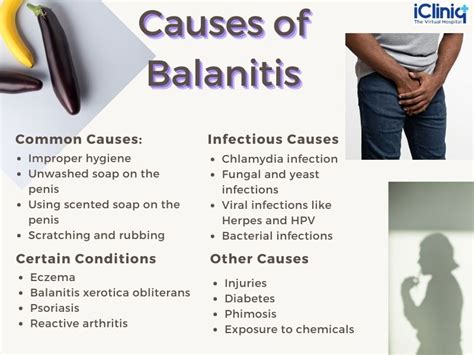 Balanitis Causes Signs Symptoms And Treatment | The Best Porn Website