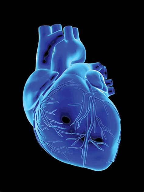 Blood Test Gives Early Warning of Failing Heart Transplant | Scientific American