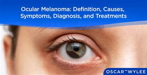 Ocular Melanoma: Definition, Causes, Symptoms, Diagnosis, and Treatments