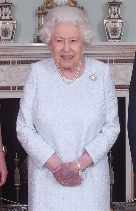 Queen Elizabeth's Bruised Hand Causes Concern in New Photos