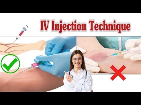 Intravenous Injection Sites