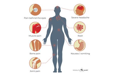 Dengue - Mosquito Alert