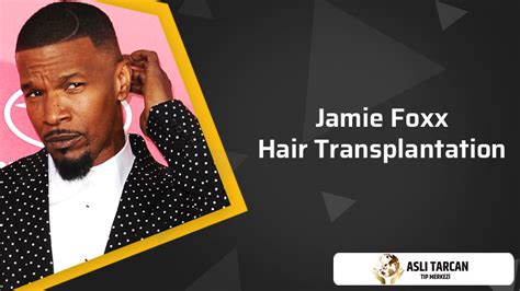 Jamie Foxx hair transplantation | Asli Tarcan Clinic