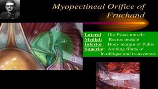 Myopectineal Orifice