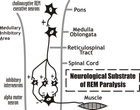 REM Sleep Behavior Disorder; Rapid Eye Movement Sleep Behavior Disorder