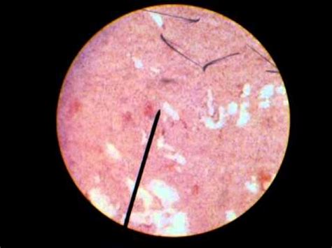 ESCHERICHIA COLI GRAM STAINED NEGATIVE - YouTube