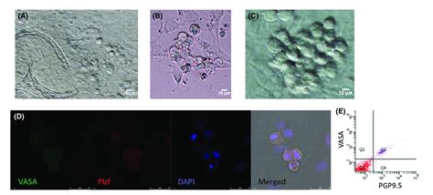 Germ cell morphologies in differentiation culture system. (A, B) germ... | Download Scientific ...